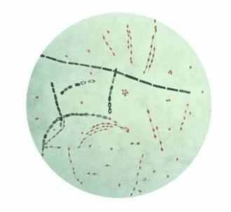 Common Diseases of Animals Anthrax Disease